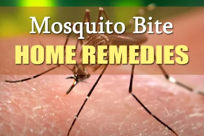 How to get Cures For Mosquito Bites leave you alone