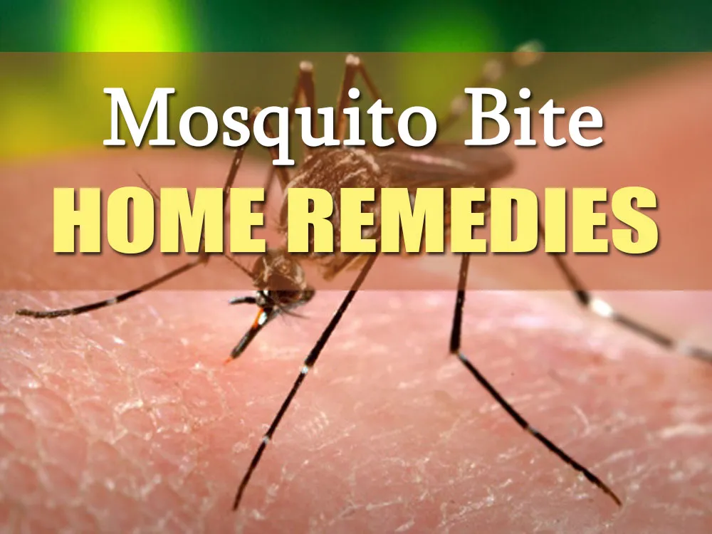 How to get Cures For Mosquito Bites leave you alone