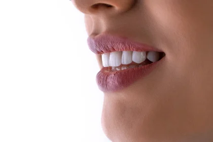 What expenses are associated with wisdom tooth elimination?