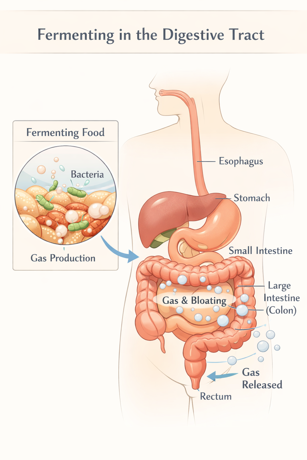 Illustration explaining food fermentation and gas buildup in digestion