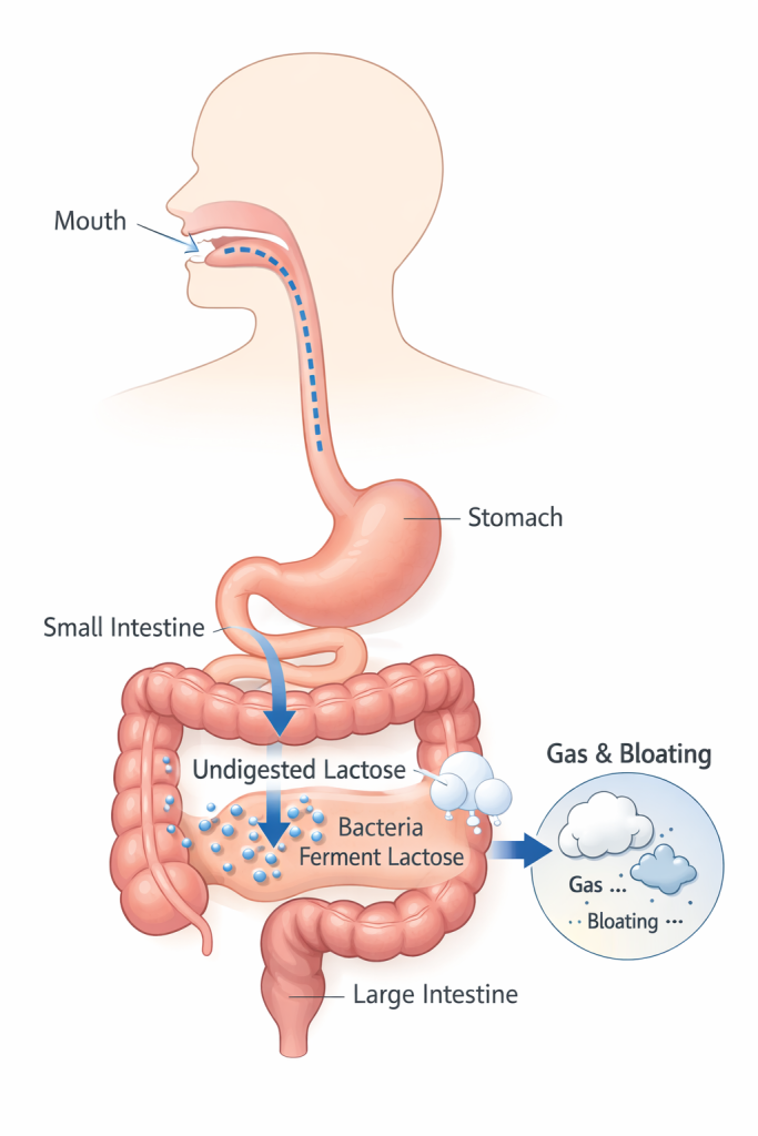 Diagram explaining lactose digestion and bloating